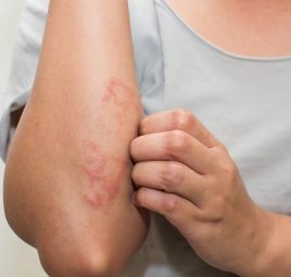 Cái ghẻ có sống trong đệm không?